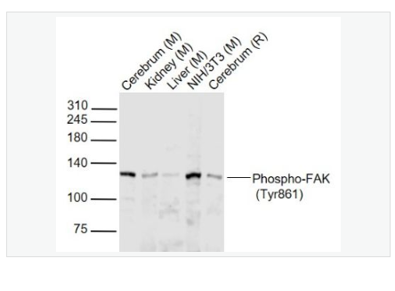 Anti-Phospho-FAK antibody  -磷酸化粘着斑激酶抗体,Phospho-FAK (Tyr861)