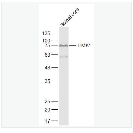 Anti-LIMK1  antibody  -单丝氨酸蛋白激酶1抗体,LIMK1