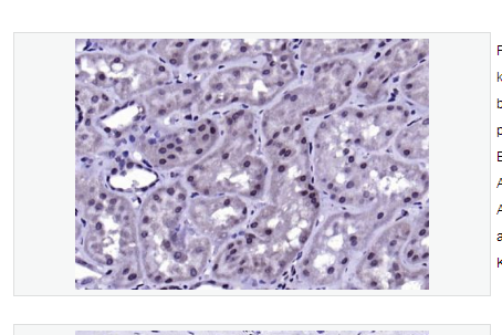 Anti-phospho-IKK beta  antibody  -磷酸化KB抑制蛋白激酶β抗体,phospho-IKK beta (Tyr188)