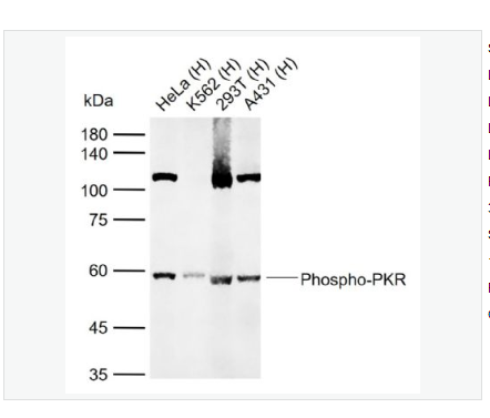 Anti-Phospho-PKR antibody  -磷酸化干扰素诱导的双链RNA活化蛋白激酶抗体,Phospho-PKR (Thr446 + Thr451)