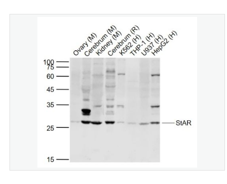 Anti-StAR antibody  -促黄体激素诱导蛋白抗体,StAR