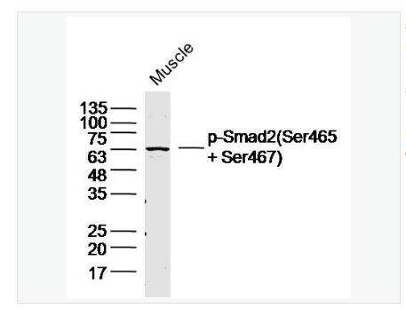 Anti-Phospho-Smad2 antibody  -磷酸化細胞信號轉導分子SMAD2抗體,Phospho-Smad2 (Ser465 + Ser467)