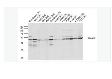 Anti-Smad3 antibody  -細胞信號轉(zhuǎn)導(dǎo)分子SMAD3抗體,Smad3