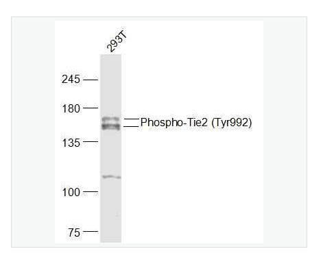 Anti-Phospho-Tie2 antibody  -磷酸化血管生成素受體2抗體,Phospho-Tie2 (Tyr992)