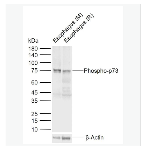 Anti-Phospho-p73 antibody  -磷酸化腫瘤蛋白P73抗體,Phospho-p73 (Tyr99)