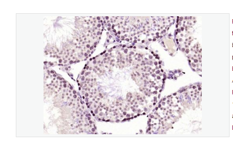 Anti-phospho-PKC delta antibody  -磷酸化蛋白激酶C亚性D型抗体,phospho-PKC delta (Thr505)