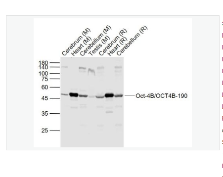 Anti-Oct-4B/OCT4B-190 antibody  -胚胎干细胞关键蛋白190抗体(N端),Oct-4B/OCT4B-190