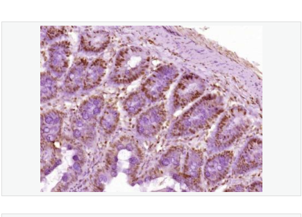 Anti-Histone H3 antibody  -乙酰化組蛋白H3抗體,Histone H3 (Acetyl K23)