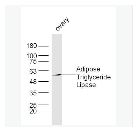 Anti-Adipose Triglyceride Lipase antibody  -脂肪甘油三酯脂酶抗体,HAdipose Triglyceride Lipase