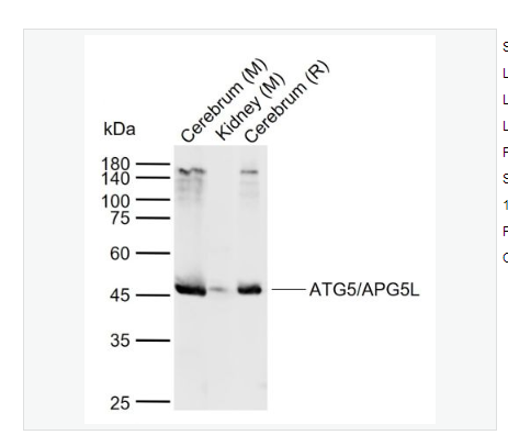 Anti-ATG5/APG5L antibody  -自噬蛋白5/细胞凋亡的特异性蛋白抗体,ATG5/APG5L