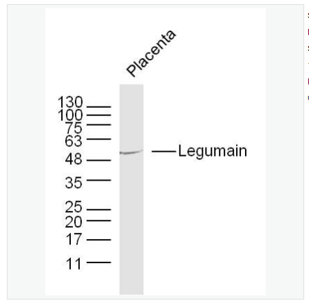 Anti-Legumain  antibody  -半胱氨酸蛋白酶抗体,Legumain