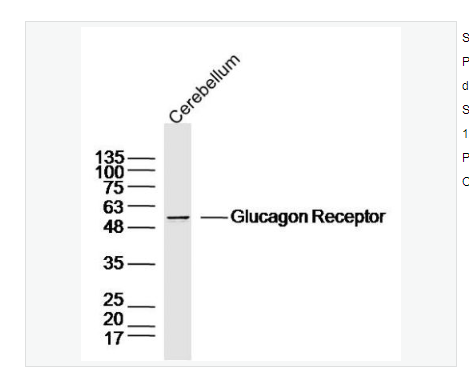 Anti-Glucagon Receptor  antibody  -胰高血糖素受體抗體,Glucagon Receptor