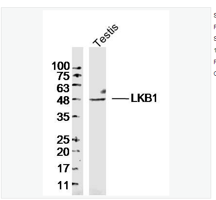 Anti-LKB1  antibody  -苏氨酸蛋白激酶LKB1抗体,LKB1