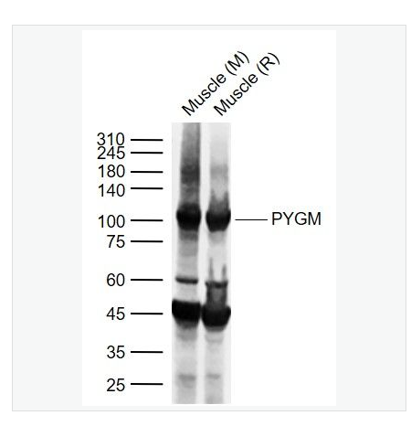 Anti-PYGM antibody  -肌肉糖原磷酸化酶抗体,PYGM