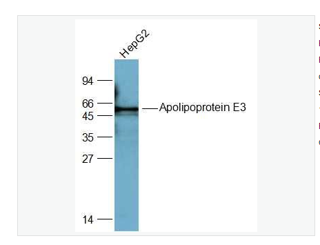 Anti-Apolipoprotein E3 antibody  -载脂蛋白E3抗体,Apolipoprotein E3