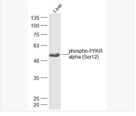 Anti-phospho-PPAR alpha antibody  -磷酸化α型-過氧化酶活化增生受體抗體,Aphospho-PPAR alpha (Ser12)