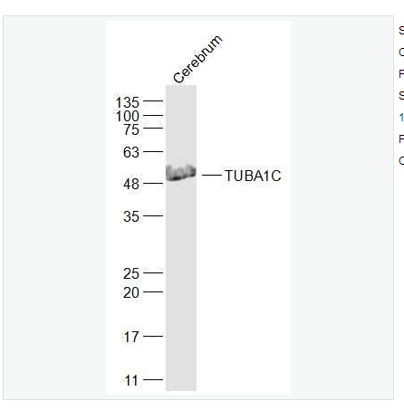 Anti-TUBA1C antibody  -微管相關(guān)蛋白α6抗體,TUBA1C