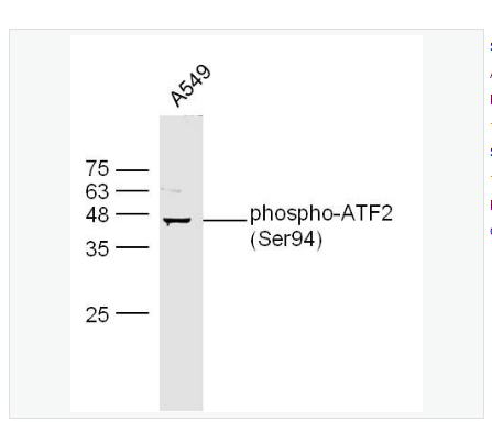 Anti-phospho-ATF2 antibody  -磷酸化活化復制因子2抗體,phospho-ATF2 (Ser94)