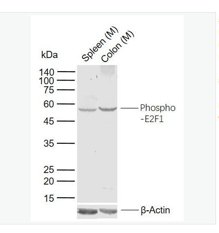 Anti-phospho-E2F1 antibody  -磷酸化转录因子E2F-1抗体,phospho-E2F1 (Ser337)