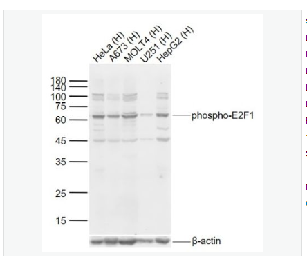 Anti-phospho-E2F1  antibody  -磷酸化转录因子E2F-1抗体,phospho-E2F1 (Ser332)