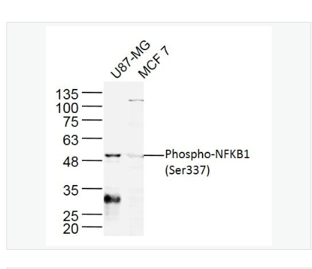 Anti-Phospho-NFKB1  antibody  -磷酸化細胞核因子p50/k基因結合核因子抗體,Phospho-NFKB1 (Ser337)