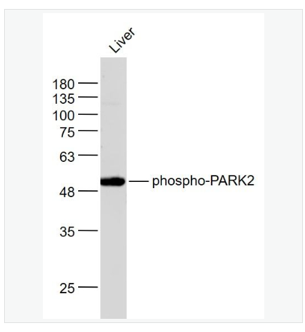 Anti-phospho-PARK2  antibody  -磷酸化帕金蛋白抗体,phospho-PARK2 (Ser378)