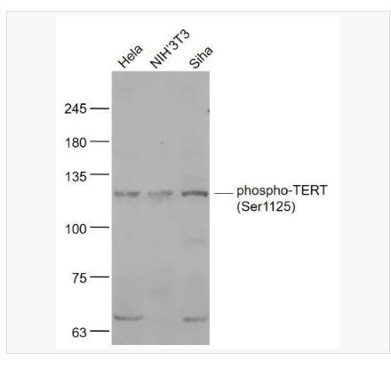 Anti-phospho-TERT  antibody  -磷酸化端粒酶逆转录酶抗体,phospho-TERT (Ser1125)
