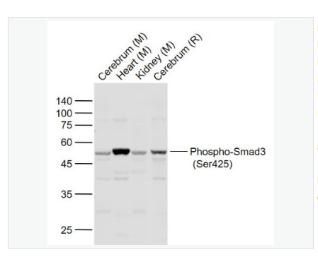 Anti-Phospho-Smad3  antibody  -磷酸化细胞信号转导分子SMAD3抗体,Phospho-Smad3 (Ser425)