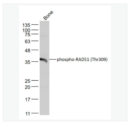 Anti-phospho-RAD51  antibody  -磷酸化Rad51抗体,phospho-RAD51 (Thr309)