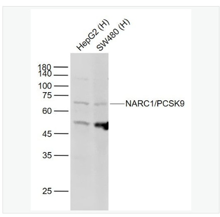 Anti-NARC1/PCSK9 antibody-神经细胞凋亡调节转化蛋白1/前蛋白转化酶枯草溶菌素9抗,NARC1/PCSK9