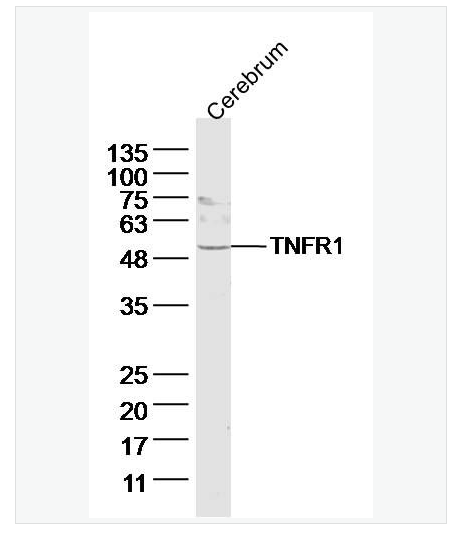 Anti-TNFR1 antibody-腫瘤壞死因子受體1抗體,TNFR1