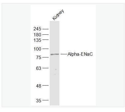 Anti-Alpha-ENaC antibody-钠通道蛋白α 抗体,Alpha-ENaC