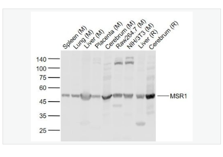 Anti-MSR1 antibody-巨噬細(xì)胞清道夫受體1抗體,MSR1