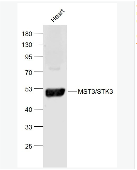 Anti-MST3/STK3 antibody-丝氨酸/苏氨酸蛋白激酶3抗体,MST3/STK3