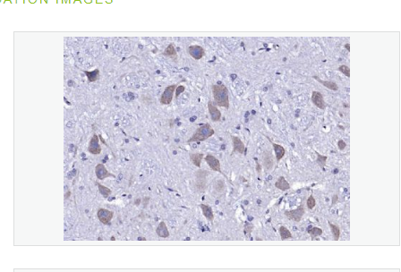 Anti-Neurotrophin 3 antibody-神经营养因子3抗体,Neurotrophin 3