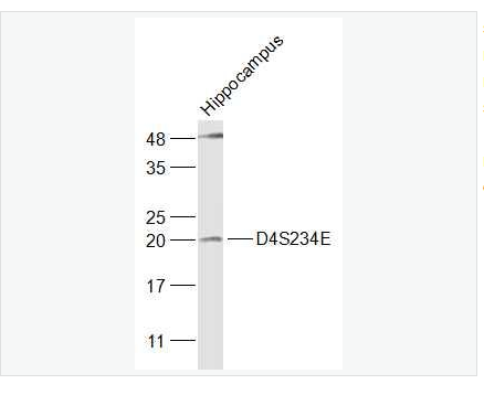 Anti-D4S234E antibody-NEEP21蛋白抗體,D4S234E