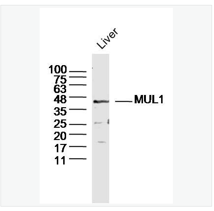 Anti-MUL18 antibody-E3泛素连接酶MUL1抗体,MUL1