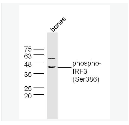 Anti-phospho-IRF3 antibody-磷酸化干擾素調節(jié)因子3抗體,phospho-IRF3 (Ser386)