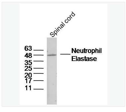 Anti-Neutrophil Elastase antibody-中性粒細胞彈性蛋白酶ELANE抗體,Neutrophil Elastase