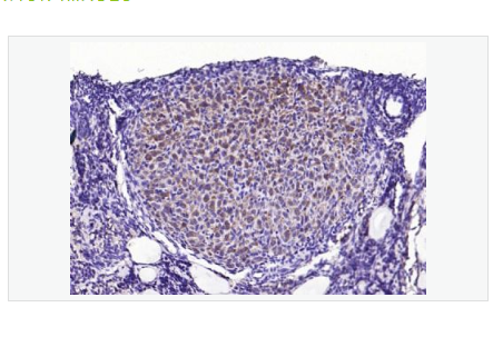 Anti-phospho-STMN1 antibody-磷酸化原癌基因蛋白18抗體,phospho-STMN1 (Ser63)