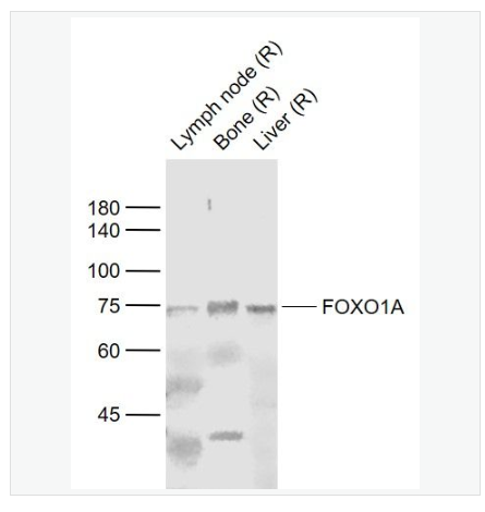 Anti-FOXO1A  antibody-叉头蛋白O1抗体,FOXO1A