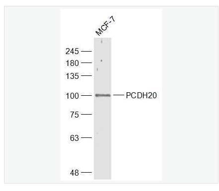 Anti-PCDH20 antibody-原钙粘附蛋白20抗体,PCDH20