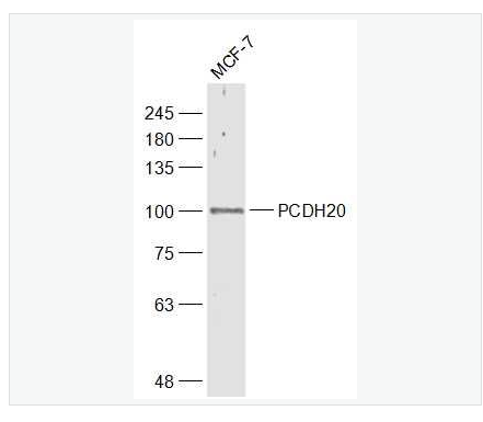 Anti-PCDH20 antibody-原鈣粘附蛋白20抗體,PCDH20