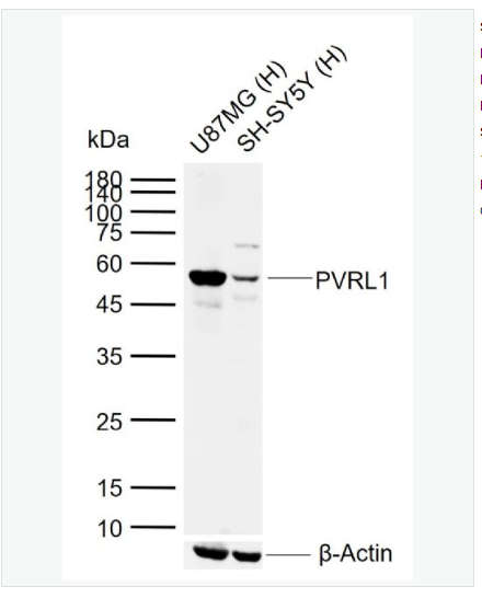 Anti-PVRL1 antibody-脊髓灰質(zhì)炎受體相關(guān)蛋白1抗體,PVRL1