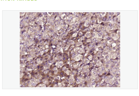 Anti-MPO antibody-髓过氧化物酶抗体,MPO