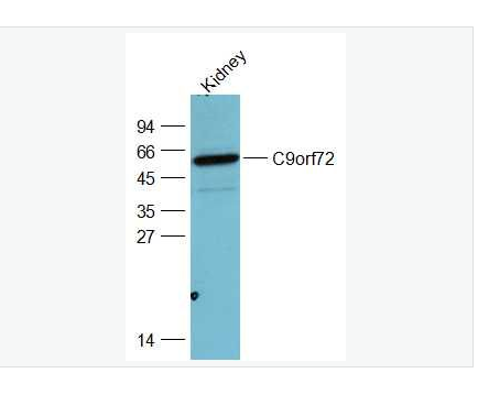 Anti-C9orf72 antibody-9号染色体开放阅读框72抗体,C9orf72