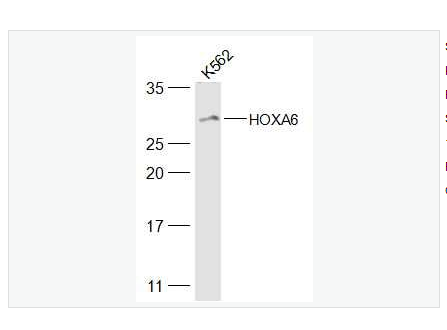 Anti-HOXA6 antibody-同源盒基因HOXA6蛋白抗体,HOXA6