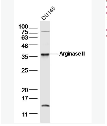Anti-Arginase IIantibody-精氨酸酶2抗体,Arginase II