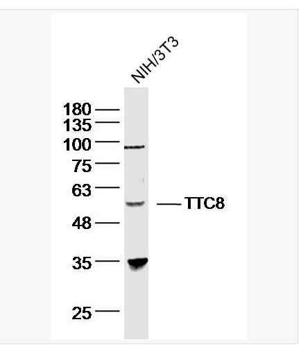 Anti-TTC8 antibody-巴尔得-别德尔综合征相关蛋白8抗体,TTC8