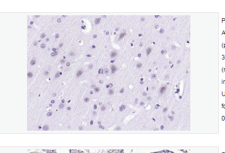 Anti-Gemin 2  antibody-脊髓性肌萎縮癥蛋白SMA抗體,Gemin 2